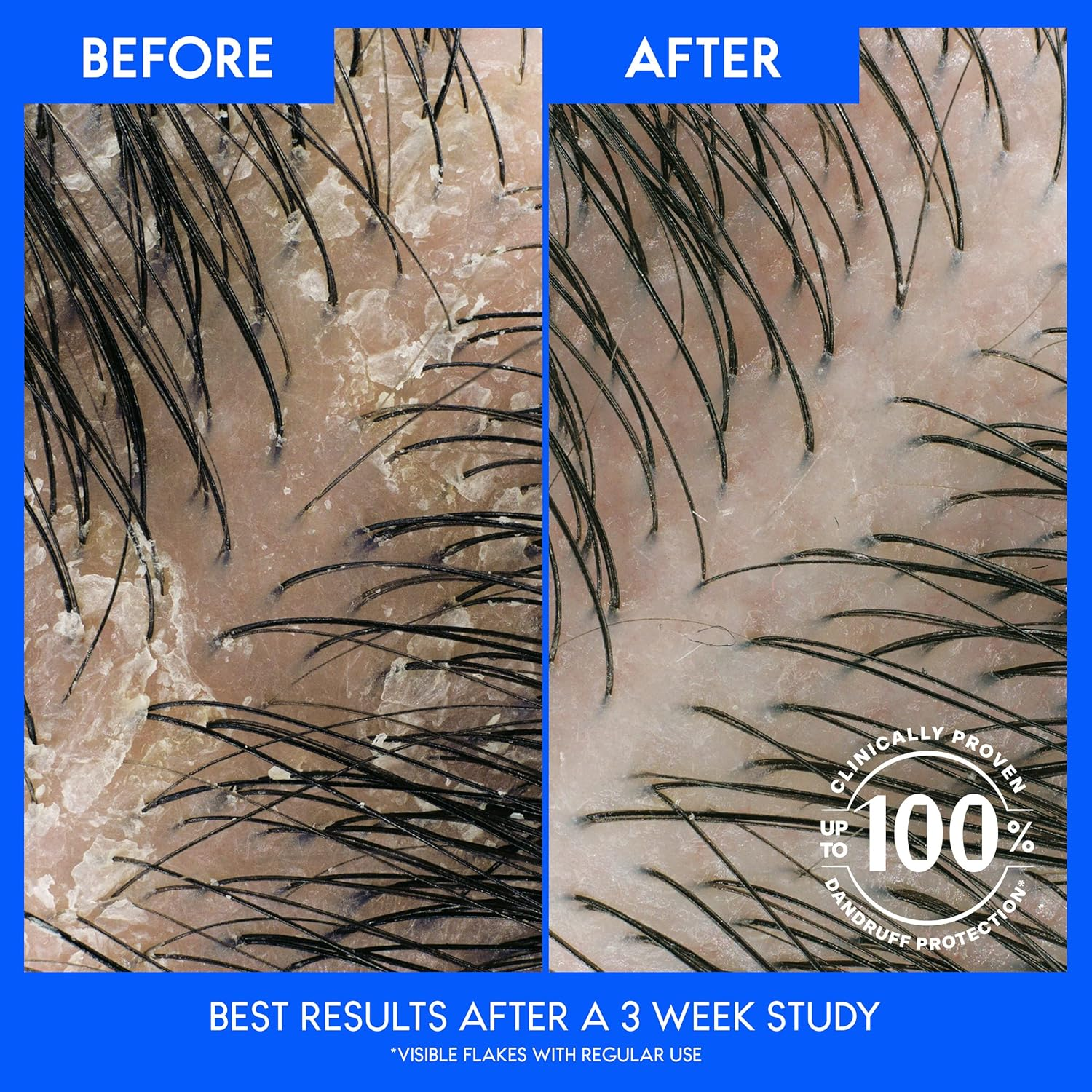 Anti-Dandruff Shampoo and Conditioner, Full and Thick 2-In-1 Twin Pack, 1% Pyrithione Zinc, Cleans to Restore Fullness to Thinning Hair, 32.1 Fl Oz Each - Image 5